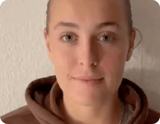 💬 Access to a private chat with Alexis and the team